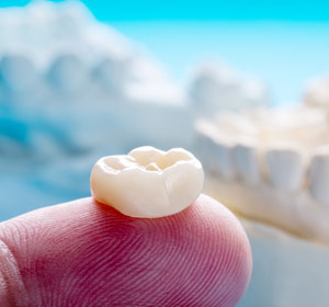 Dental Crowns and Caps